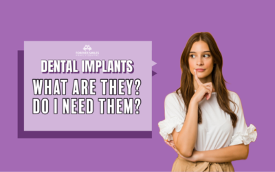 Dental Implants: What Are They? Do I Need Them?