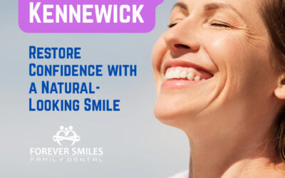 Dental Implants in Kennewick: Restore Confidence with a Natural-Looking Smile